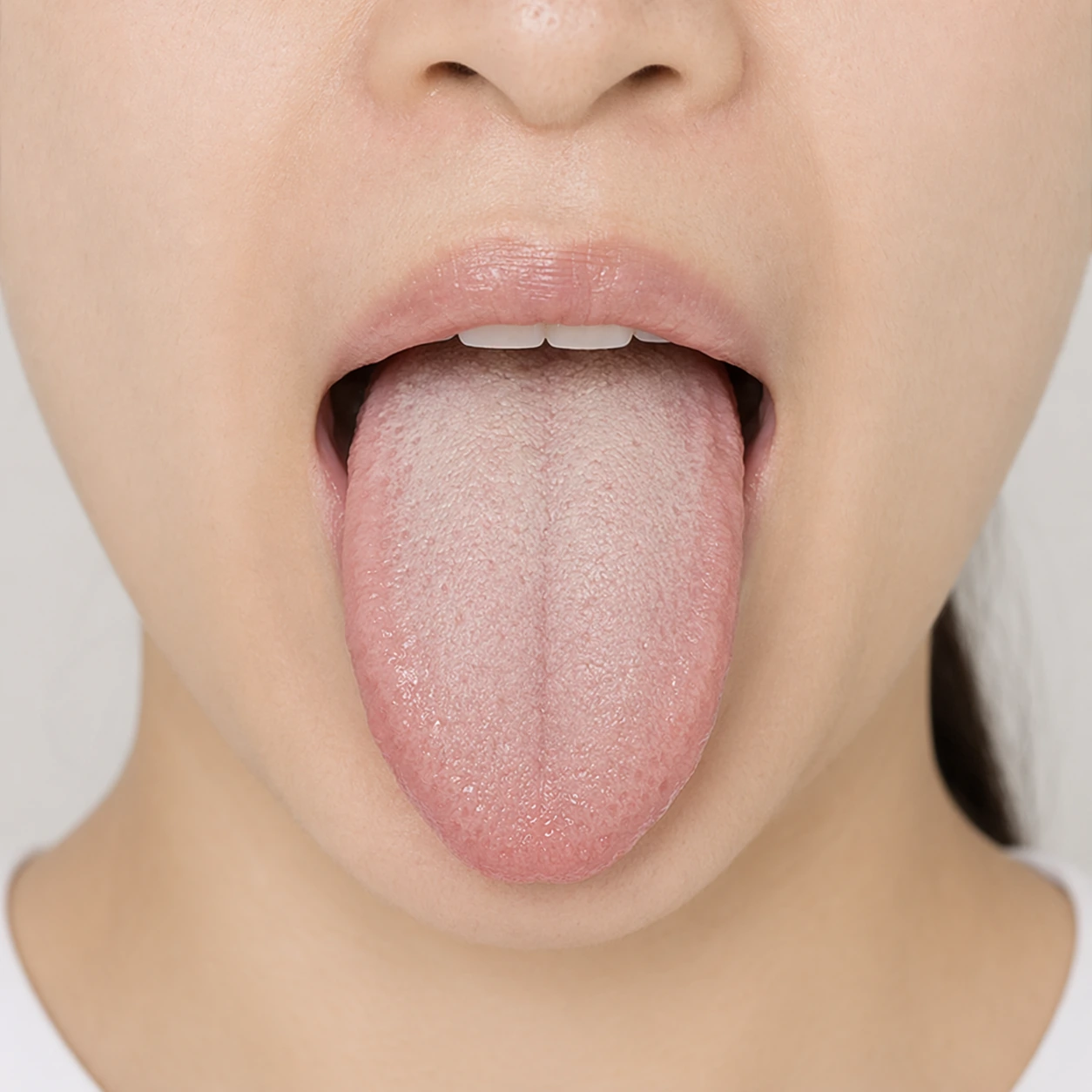 Artistic tongue observation example